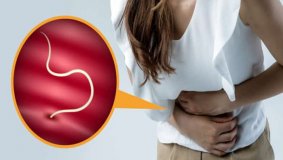 Каковы симптомы и способы лечения аскаридоза у взрослых?